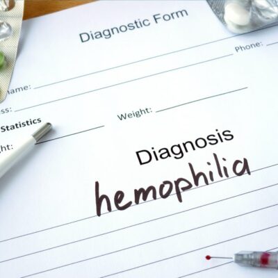 Here&#8217;s what to eat for hemophilia